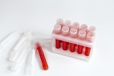 kimse kan plastik tüpler