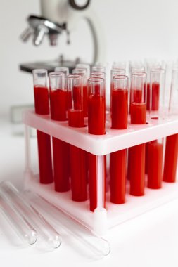 cam tüpler mikroskop arka plan üzerinde kan