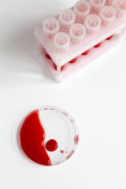 plastik tüpleri, petri kan çanağı herhangi bir Üstten Görünüm