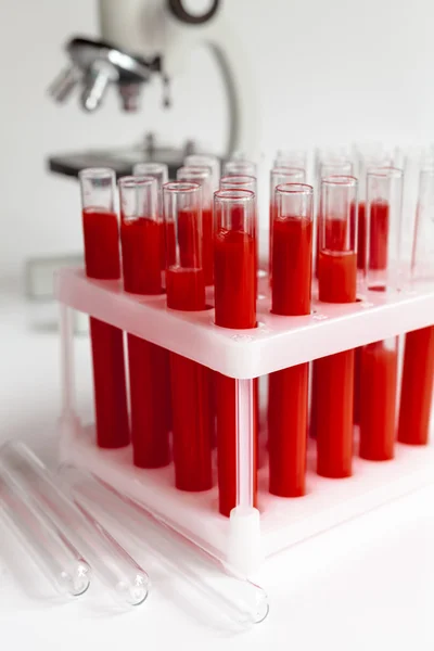 Krev do skleněných zkumavek na pozadí mikroskopu — Stock fotografie