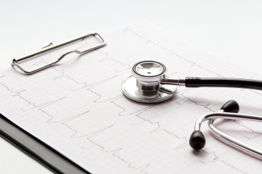 kardiyogram ile beyaz bir arka plan üzerinde yeni stetoskop