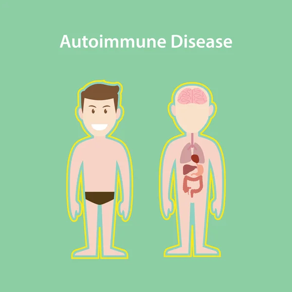 Autoimmune disease system illustration with cartoon human man body  protection effect — Stock vektor