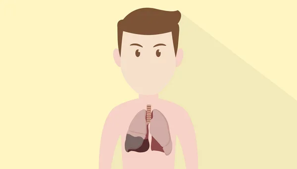 Corpo humano desenho animado rosto com pneumonia doente pulmão —  Vetores de Stock