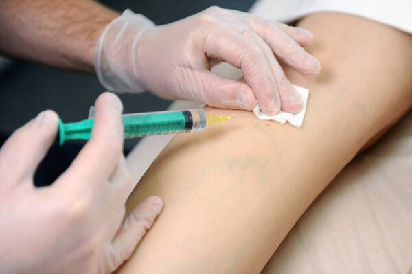 The doctor injects a syringe under the knee. A doctor makes an injection to the varicose veins on a woman s leg, close-up, sclerotherapy, stripping, phlebeurysm, medical.