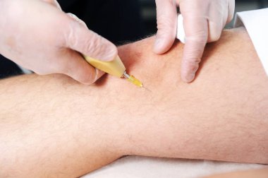 Karbondioksit terapisi (karboksiterapi). Deri yenilenmesi. İşlem erkek dizinde yapılır..