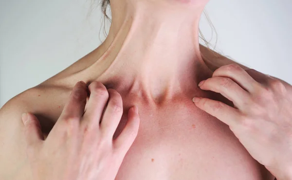 Mujer Tiene Picazón Fondo Gris Dermatitis Atópica También Conocida Como — Foto de Stock