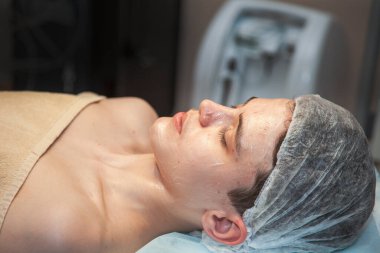 Yüz bakımı, sivilce sorunu, kozmetoloji, genç bir çocuğun yüz bakımı, kaslı..