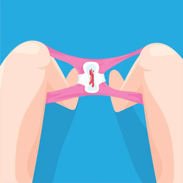 Hygienische Serviettenflügel auf weiblichen Höschen mit Menstruationsblutvektorillustration — Stockvektor