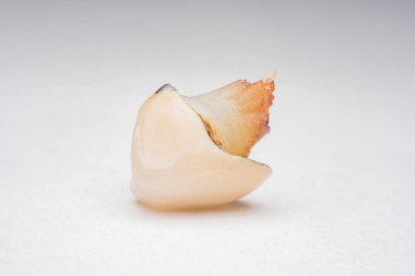 diş, diş, çürük, çürük diş