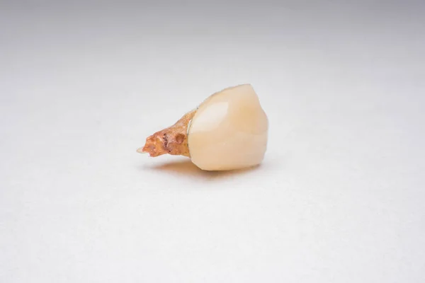 Зубы Зуб Кариес Гнилой Зуб — стоковое фото