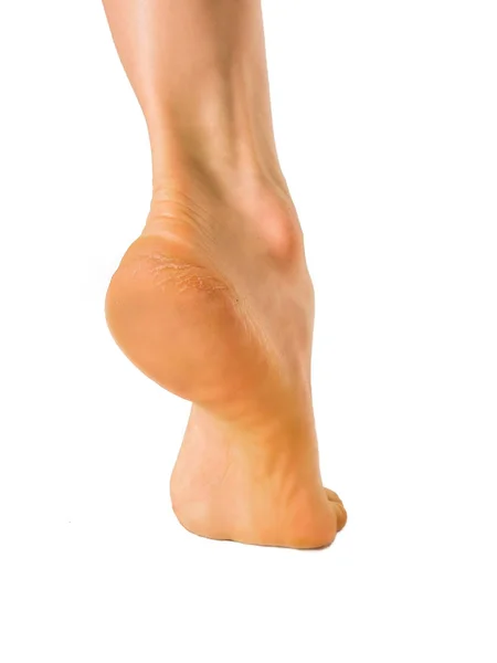 Žena popraskané podpatky s bílým pozadím, koncepce zdravé nohy — Stock fotografie