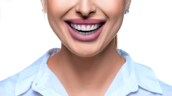 Foto de una mujer sonriente. Concepto de blanqueamiento dental . — Foto de Stock