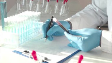 Virus. Blood sample in researchers hands.