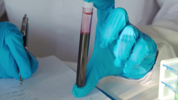 Imágenes de cerca de la muestra de sangre en manos de los investigadores . — Vídeo de stock
