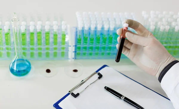 Close up photo of a doctors hands with a test tube with a blood sample. — Stock Photo, Image