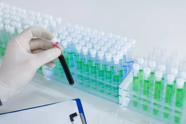 Close up photo of a doctors hands with a test tube with a blood sample. A lot of test tubes on background. — Stock Photo, Image