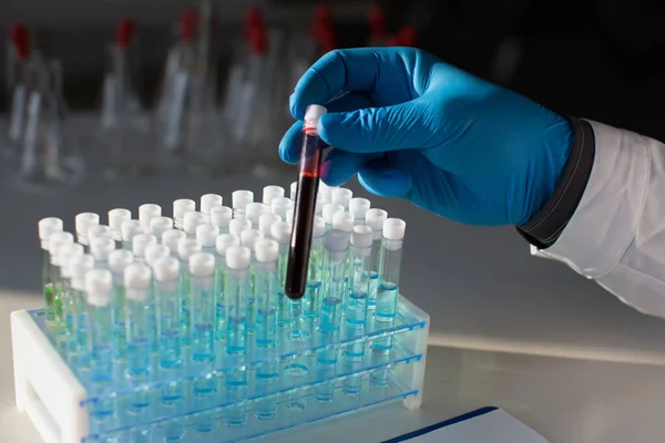 Fotografía de cerca de un tubo de ensayo con una muestra de sangre infectada en las manos de un médico en un laboratorio . — Foto de Stock