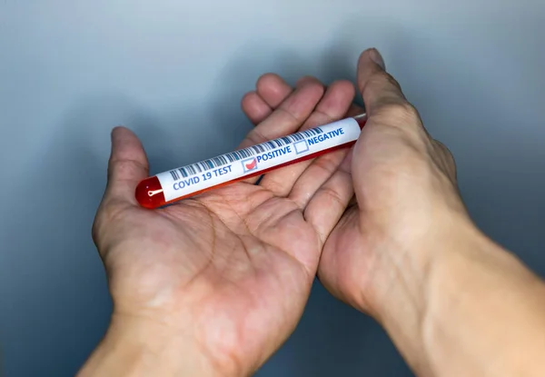 Hand Holding Test Tube Blood Covid Testing Test Tube Used — Stock Photo, Image