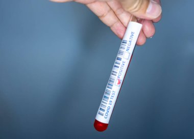 Kan testi için elinde test tüpü olan bir el. Corona virüsü testlerinde kullanılan test tüpü. Covid 19 pozitif sonuç