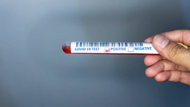 Kan testi için elinde test tüpü olan bir el. Corona virüsü testlerinde kullanılan test tüpü. Covid 19 pozitif sonuç