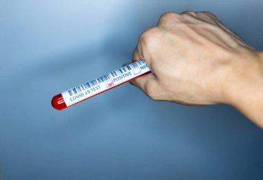 Kan testi için elinde test tüpü olan bir el. Corona virüsü testlerinde kullanılan test tüpü. Covid 19 pozitif sonuç