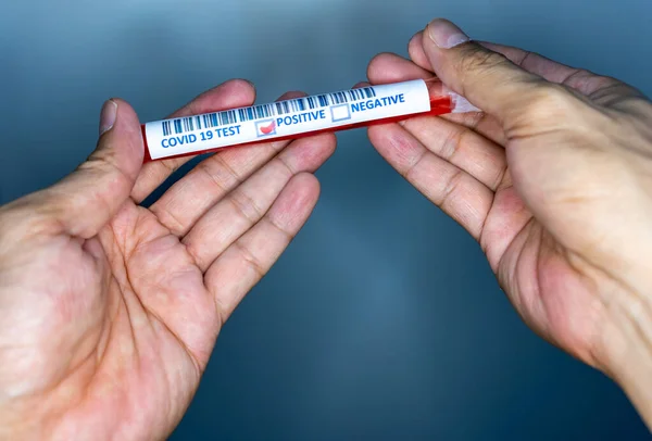 Hand holding a test tube with blood for covid 19 testing. Test tube used for corona virus testing. Covid 19 positive result