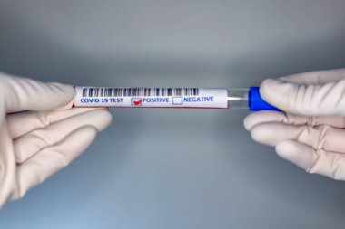 Coronavirus testi pozitif çıkmış bir hastanın test tüpünü taşıyan bir hemşire elinin bulanık görüntüsü.