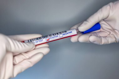 Coronavirus testi pozitif çıkmış bir hastanın test tüpünü taşıyan bir hemşire elinin bulanık görüntüsü.