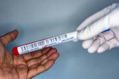 Coronavirus testi pozitif çıkmış bir hastanın test tüpünü taşıyan bir hemşire elinin bulanık görüntüsü.
