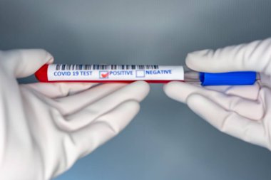 Coronavirus testi pozitif çıkmış bir hastanın test tüpünü taşıyan bir hemşire elinin bulanık görüntüsü.