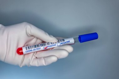 Coronavirus testi pozitif çıkmış bir hastanın test tüpünü taşıyan bir hemşire elinin bulanık görüntüsü.