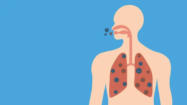 Virus Corona Covid Humanos Sistema Respiratorio Pulmones — Foto de Stock