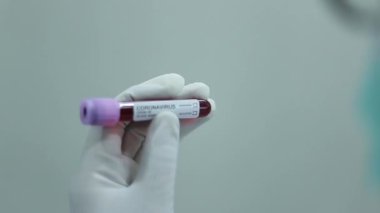 Coronavirus Covid-19, Corona virüsü salgını. Salgın Virüsü Solunum Sendromu