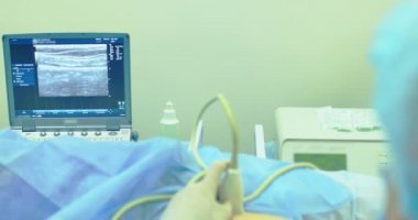 Bir doktor modern sonogram ven skleroterapi yordamda görüntülemek için kullanır. Cerrahi, yakın çekim bir yöntem ve varisli damarlar