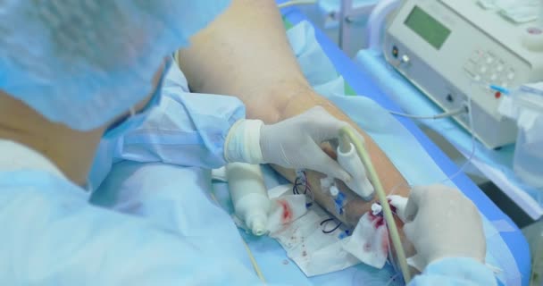 Innovativ metod för åderbråck kirurgi, sclerotherapy förfarande. Närbild skott av patientens ben — Stockvideo