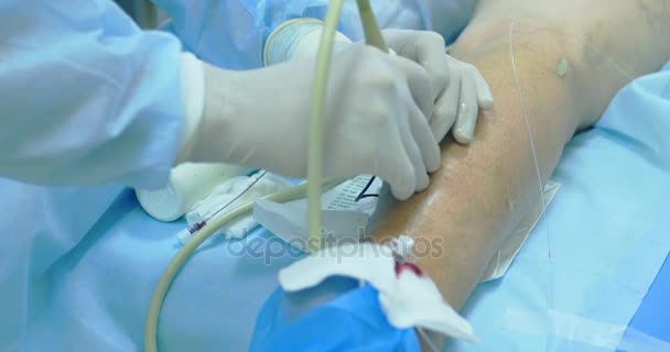 Méthode innovante de chirurgie des varices, procédure de sclérothérapie. Gros plan sur les jambes des patients — Video