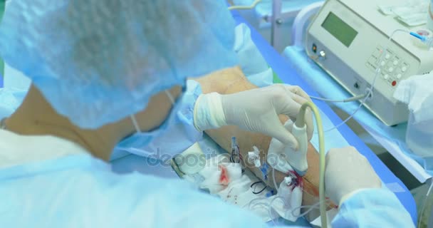Inovativní metoda operace křečových žil, skleroterapie postup. Close-up shot pacienta nohy — Stock video
