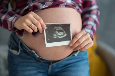 Hamile bir kadın ultrasonda çekilmiş bir bebek fotoğrafı tutuyor. Mutlu annelik kavramı