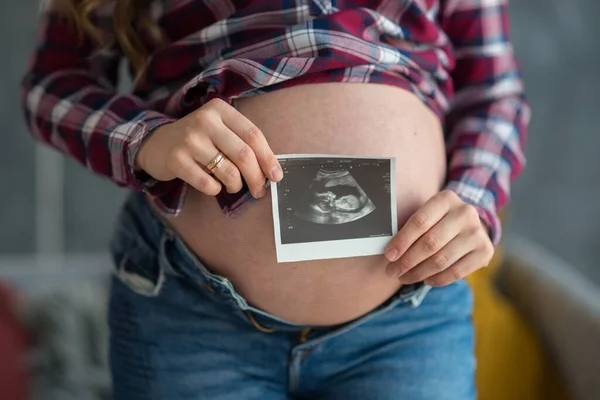 妊娠中の女性は赤ん坊の超音波写真を持っています 幸せな母親の概念は — ストック写真