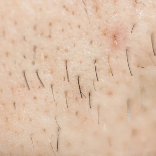 Macro Photo Man Beard — Stock Photo, Image