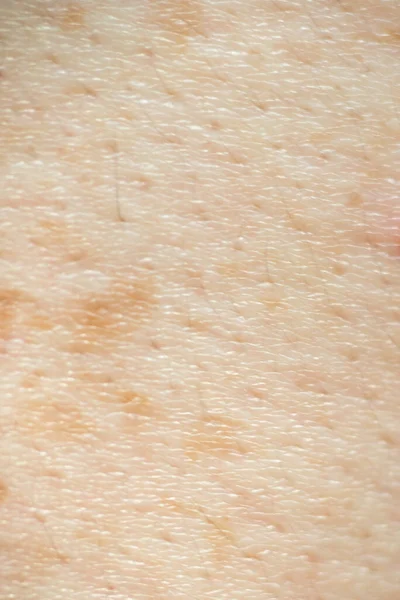 Soft Focus Human Skin Texture Black Hairs Healthy Textu — Stock Photo, Image