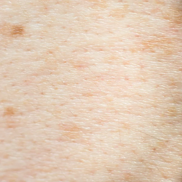 黑发软聚焦人类皮肤质感对健康肌肤的影响 — 图库照片