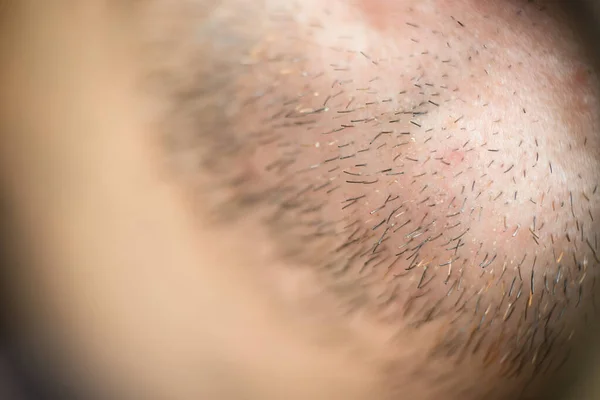Miękkie Skupienie Mans Włosy Makro Tło Grzywny Sztuka Wysokiej Jakości — Zdjęcie stockowe