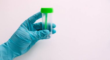 Mavi lateks eldivenli bir el dışkı toplamak için bir kap tutar. Doktorun elinde analiz için plastik kap var. Analiz kavanozu boş. Beyaz arkaplan.
