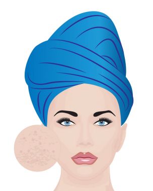 Cilt sorunları olan bir kız