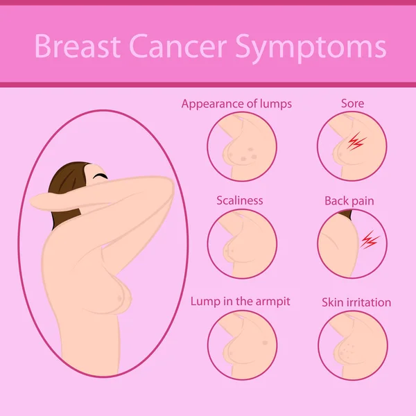 Συμπτώματα του καρκίνου του μαστού — Διανυσματικό Αρχείο