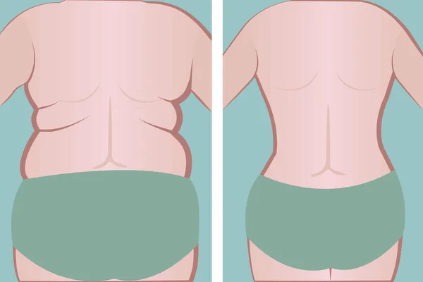 La espalda de una chica gorda y delgada. vector — Archivo Imágenes Vectoriales