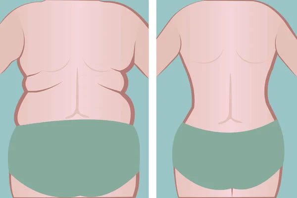 A rapariga gorda e magra voltou. vetor —  Vetores de Stock