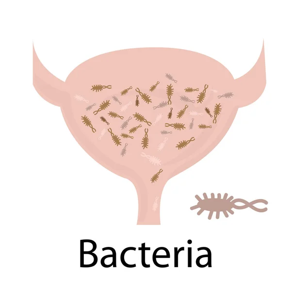 Infección del tracto urinario. Bacterias — Archivo Imágenes Vectoriales