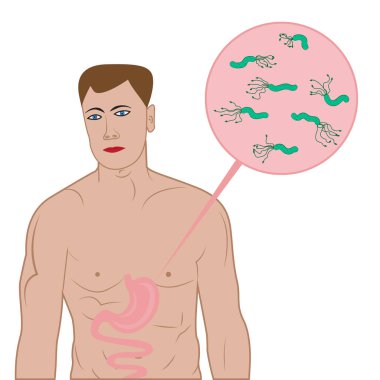 Stop helicobacter in stomach sign clipart